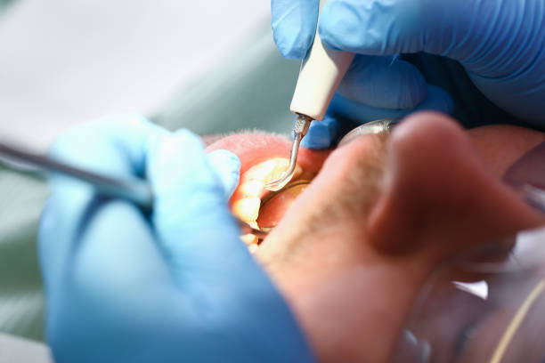 Best Emergency Root Canal Treatment in Big Le, AK