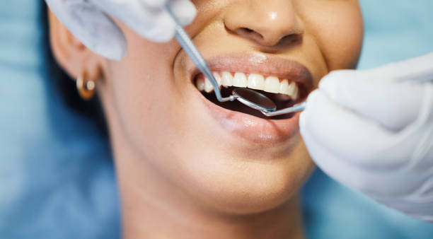 Best Same-Day Emergency Dental Services in Big Le, AK