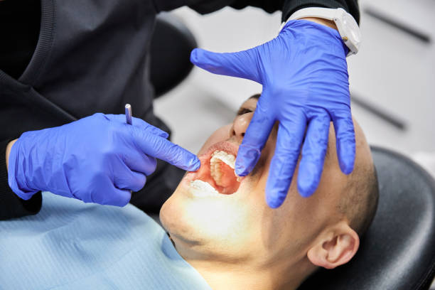 Best Emergency Wisdom Teeth Removal in Big Le, AK